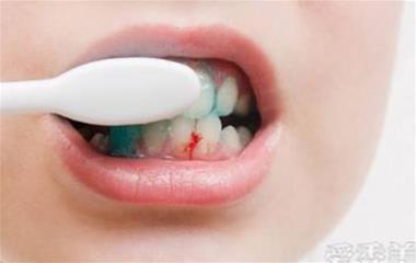 如何預防牙周炎牙齦出血？